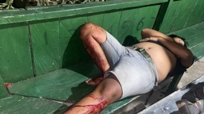 Seorang Warga Tertembak di Kompleks Pertamina Lama Tolikara